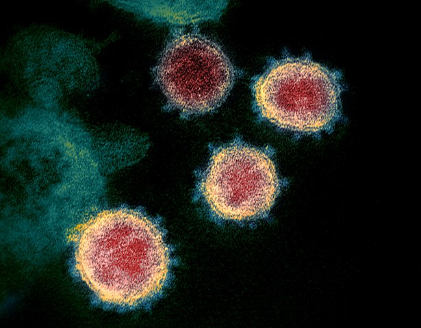 Elektronenmikroskopische Aufnahme von SARS-CoV-2-Vironen (Quelle: © Wikimedia Commons/NIAID-RML / CC BY 2.0)